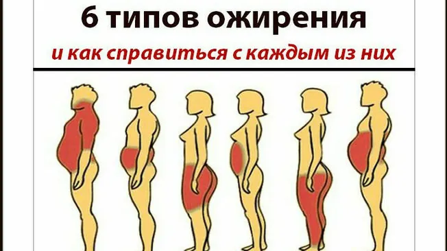 Типы ожирения. Как справиться с каждым из них